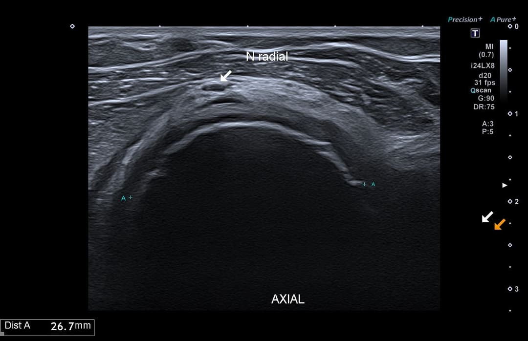 Image échographique