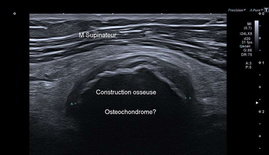 Image échographique