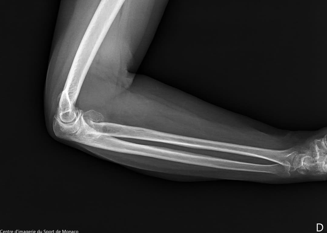 Image radiographique