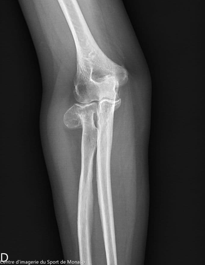 Image radiographique