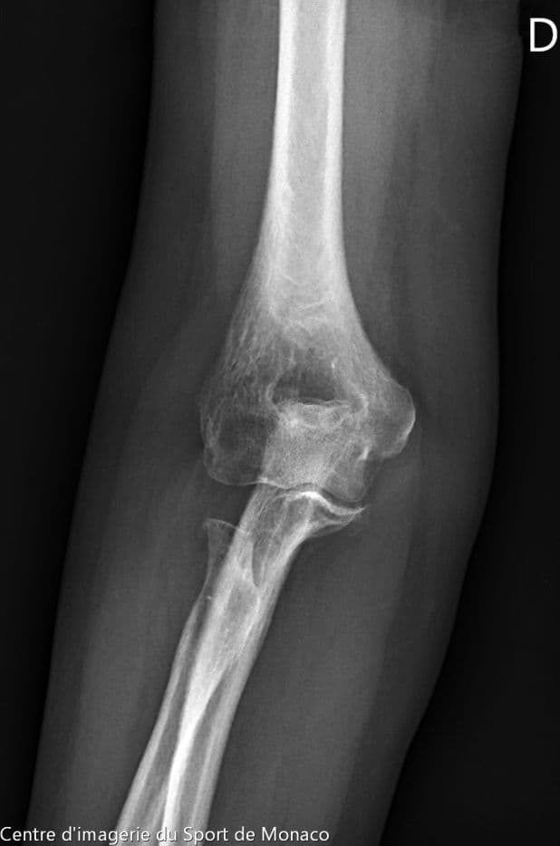 Image radiographique