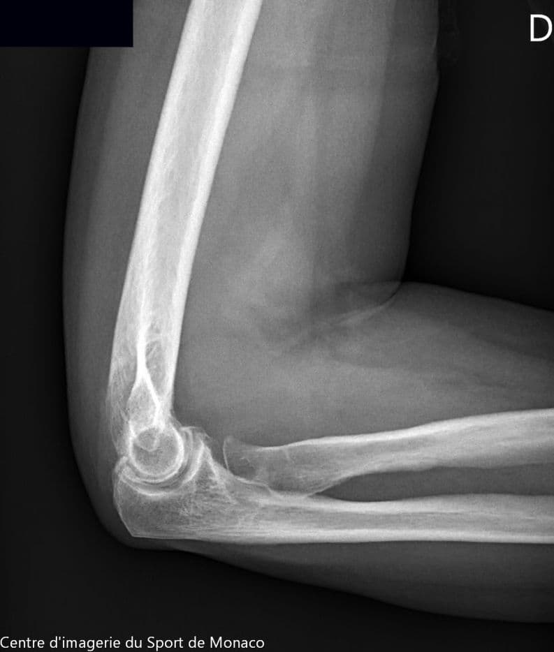 Image radiographique