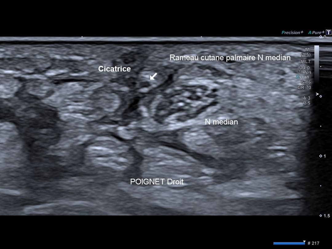 Image échographique