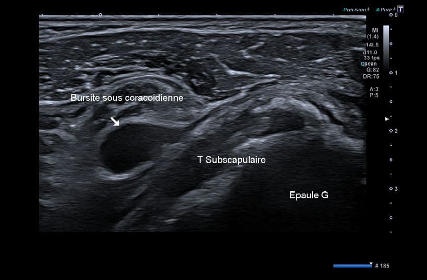 Image échographique