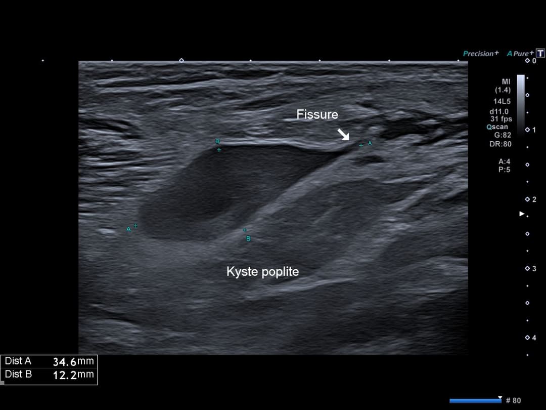 Image échographique