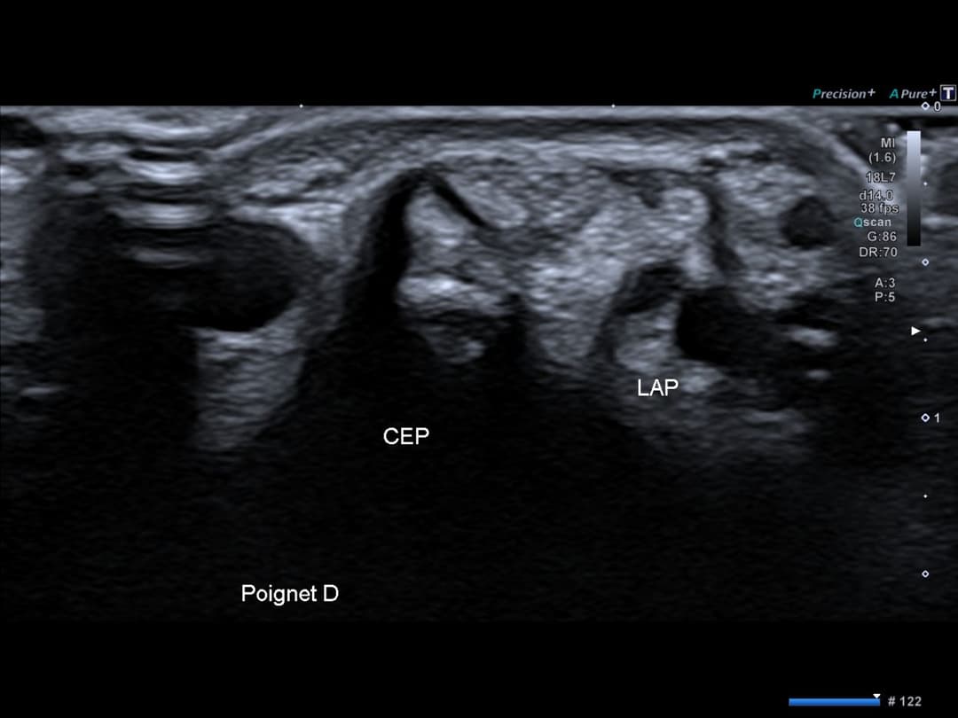 Image échographique