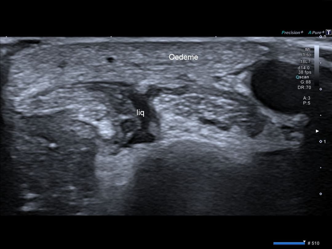 Image échographique