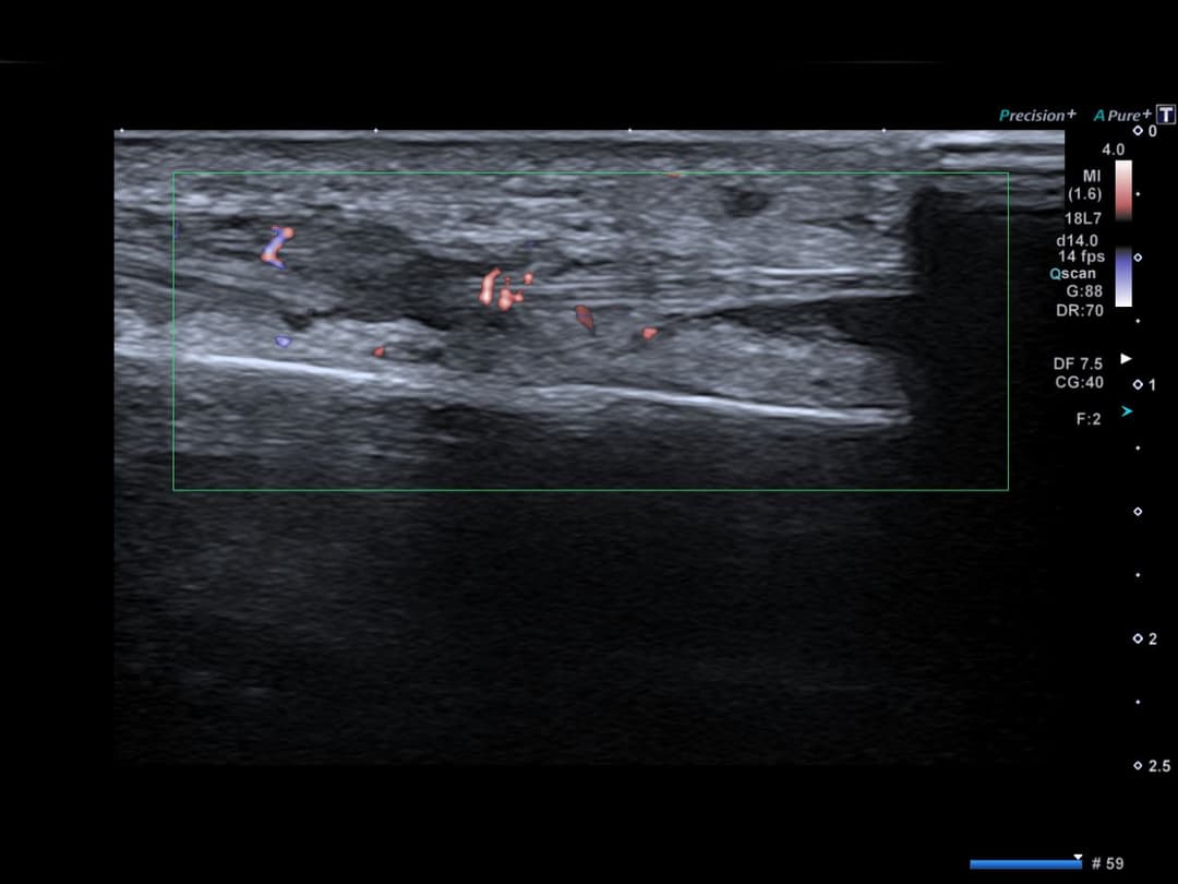 Image échographique