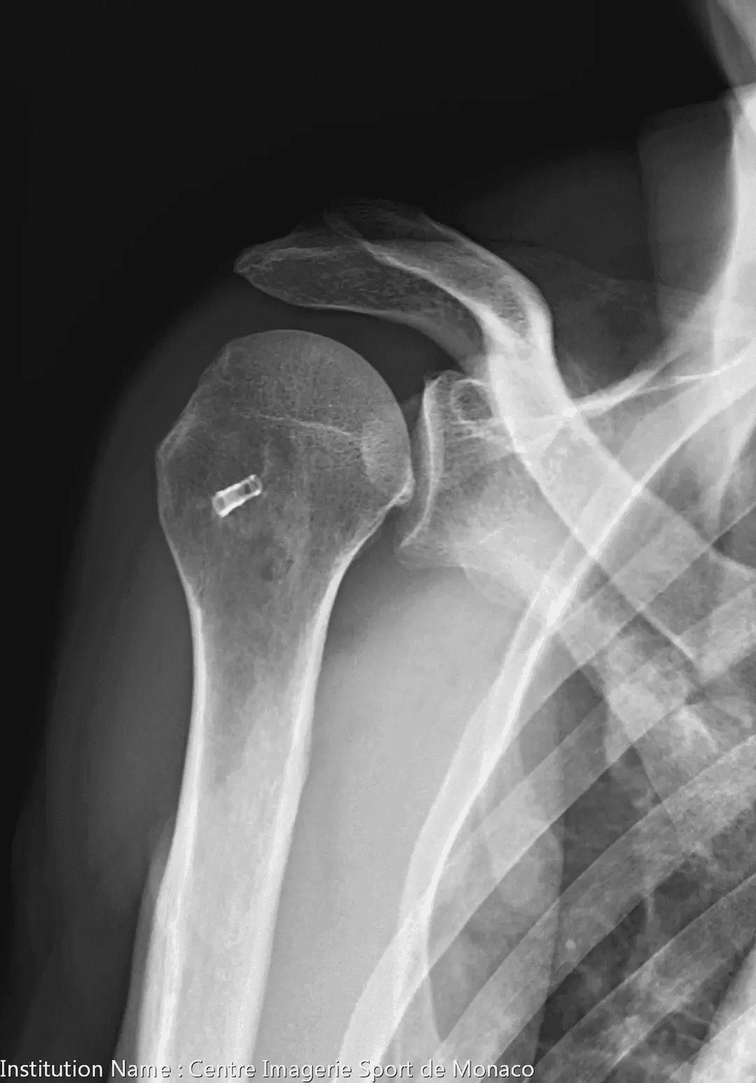 Image radiographique